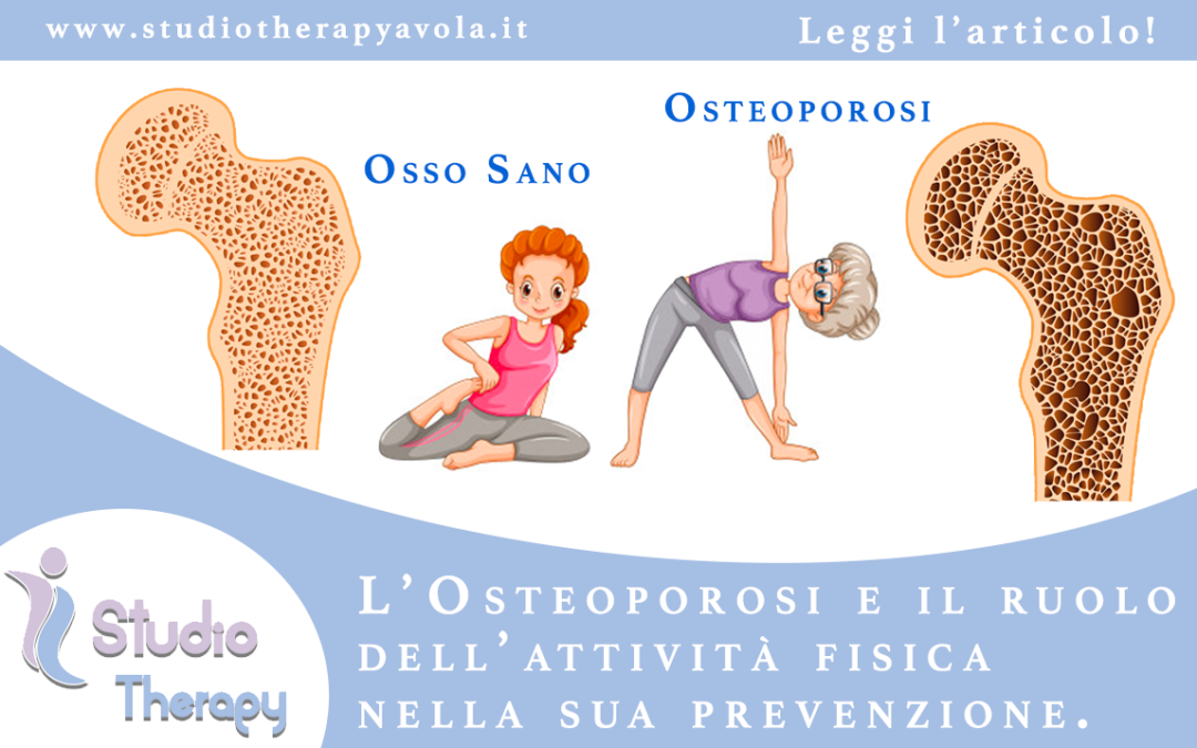 Osteoporosi, attività fisica, prevenzione